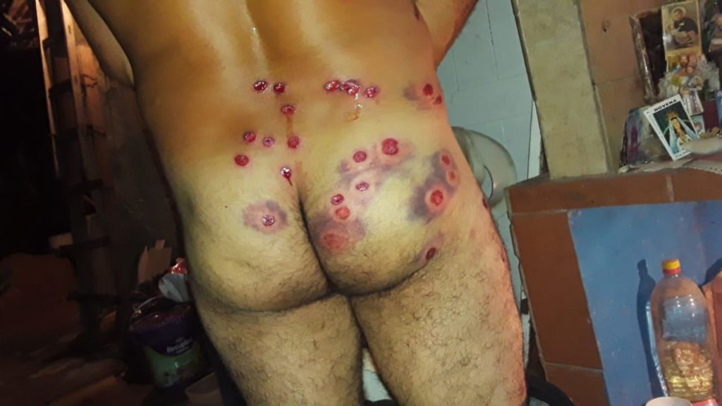 balas de goma chano