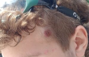 herido represion 10 4 2024